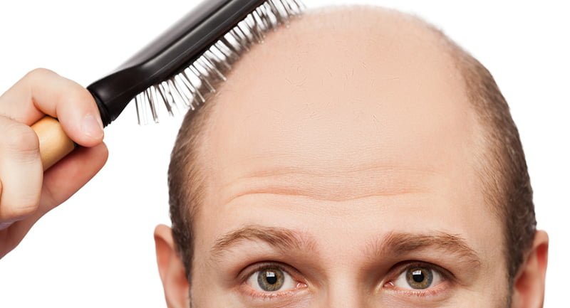 Saçlarımızı Kaybetmemize Neden Olan 9 Etken